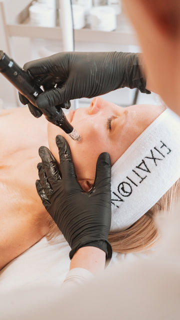 Exosomes vs Traditional Microneedling: Which Treatment Is Right For Your Skin?