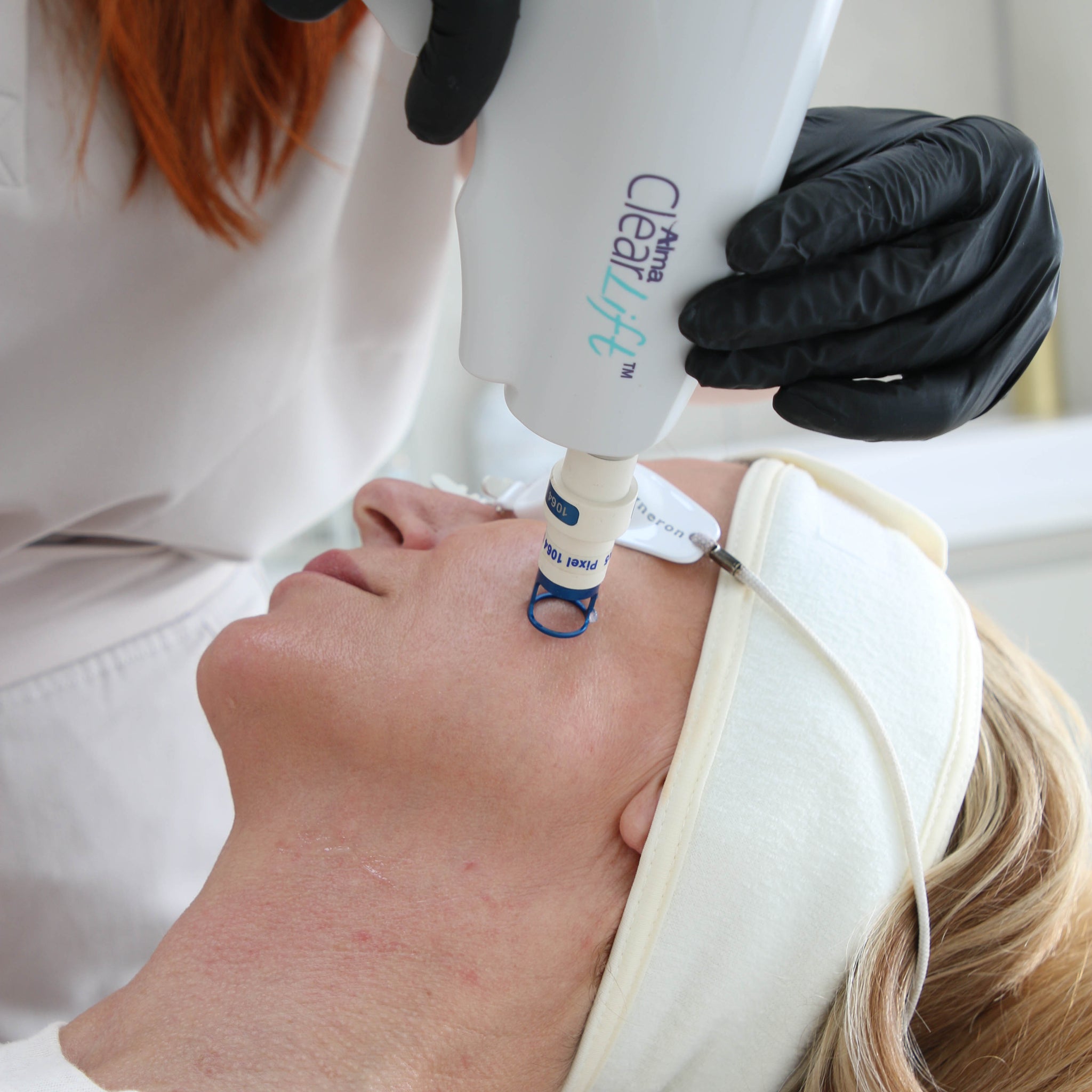 Discover the Power of ClearLift 4D: The Ultimate Non-Invasive Skin Rejuvenation Treatment