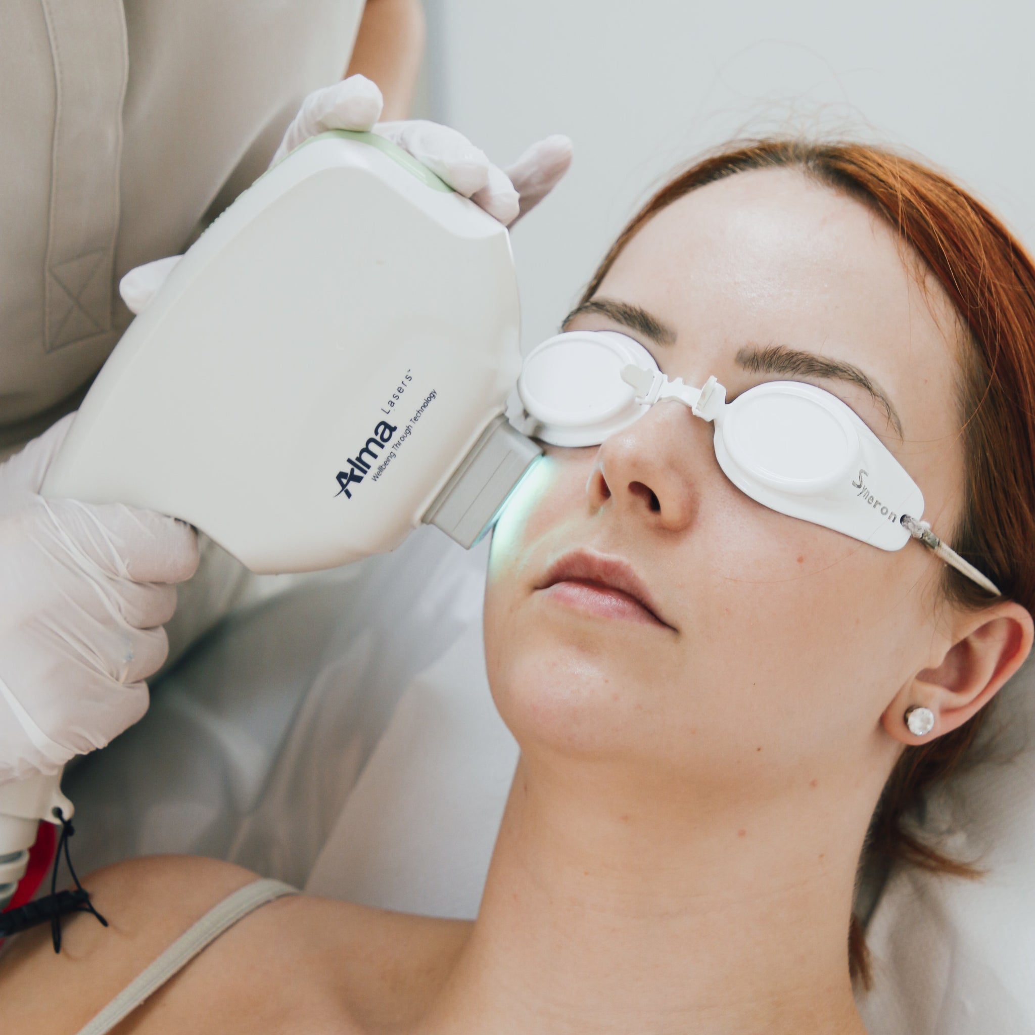 Vascular Lesion Removal: Achieve Clearer, Healthier Skin with Advanced Laser Treatment