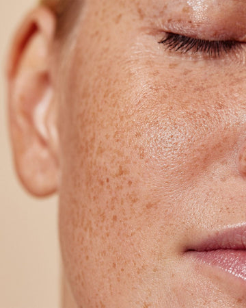 What Skin Type Are You? A Detailed Guide Written By A Skin Specialist