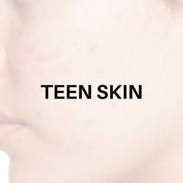 Teen Skin