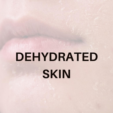 Dehydrated Skin