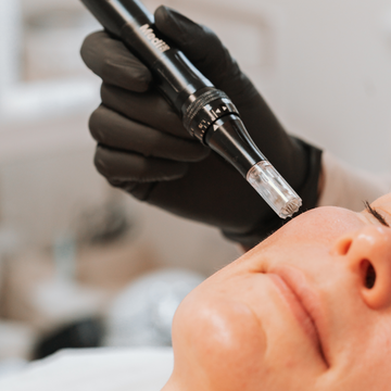 Person receiving a cosmetic procedure by a gloved hand.