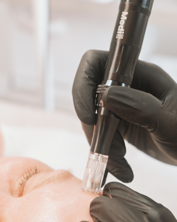 Person wearing black gloves using a medical device on a blurred background